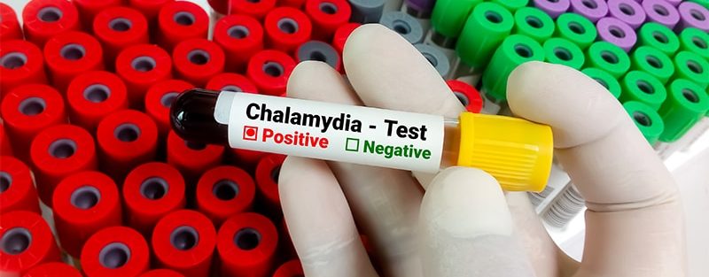 Doxycycline Kits Boost Chlamydia Treatment in ED