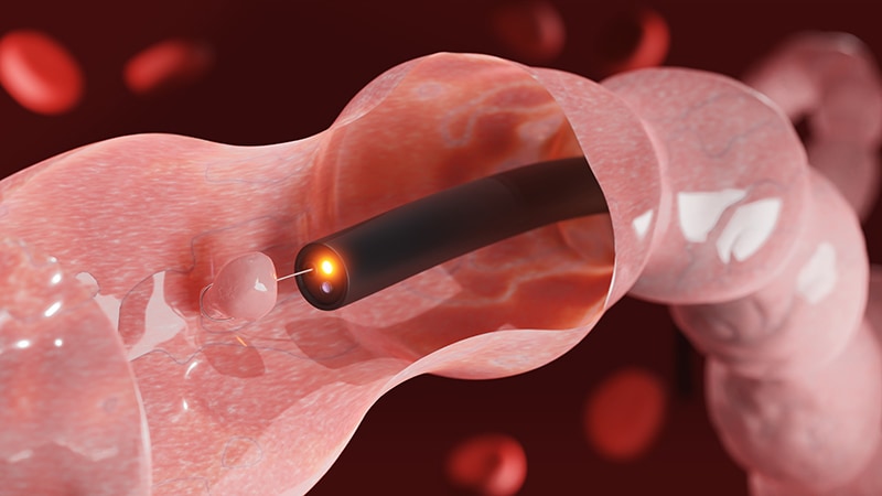 Fecal Hemoglobin Levels From Negative FITs Signal CRC Risk