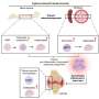 Innate immune training aggravates inflammatory bone loss in experimental models