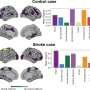 Advancing stroke imaging analysis with interpretable AI and effective connectivity models